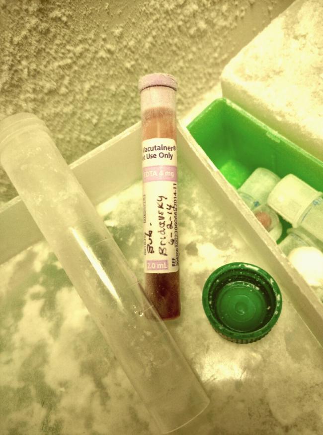 The most important thing in our freezer Experiment