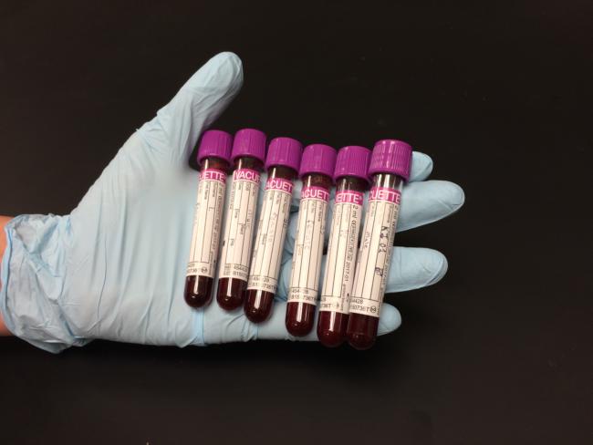 Collecting Blood Experiment